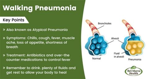How To Treat Walking Pneumonia