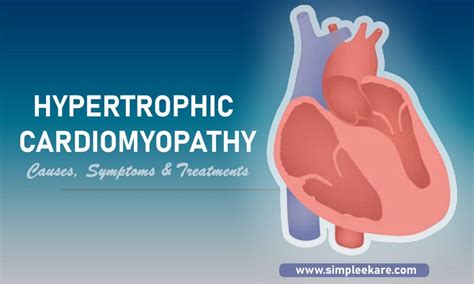 Hypertrophic Cardiomyopathy Selfcare
