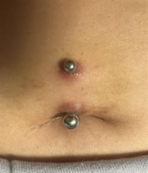 Infected Stomach Piercing