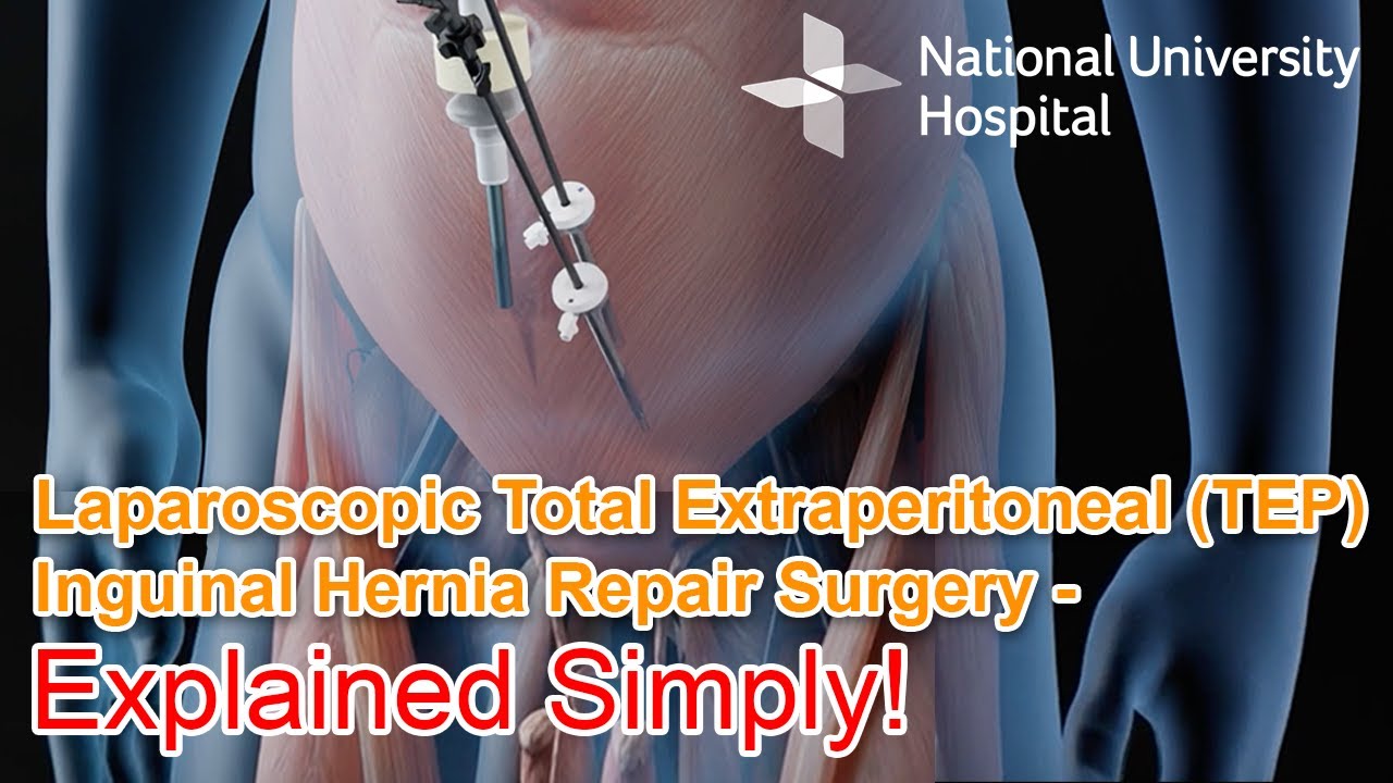 Inguinal Hernia Surgery