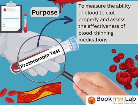 Inr Blood Test: Know Your Results