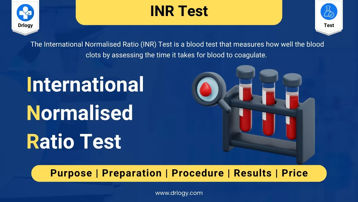 Inr Normal Range