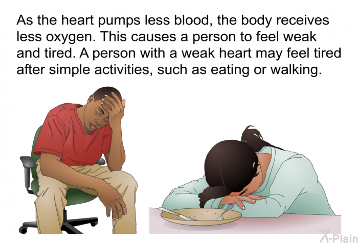 Intra Aortic Balloon Pump Guide: Expert Insights