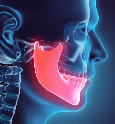 Jaw Pain Heart Attack