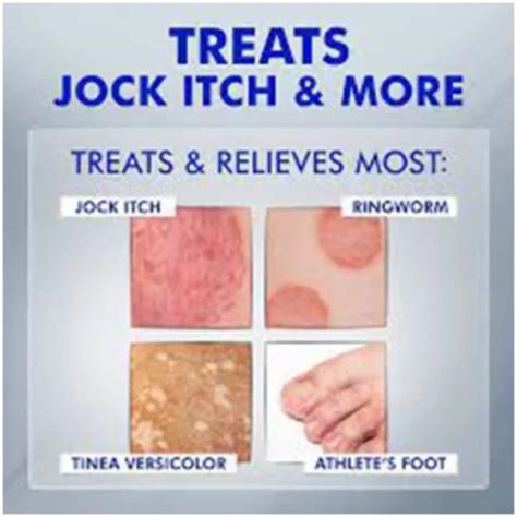 Jock Itch Treatment