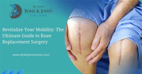 Knee Replacement Surgery: Restore Mobility And Relief