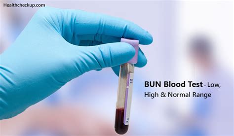 Low Bun Blood Test