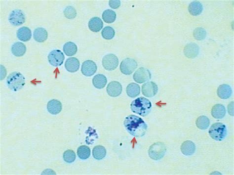 Master Reticular Site Count: Comprehensive Results