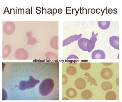 Medical Laboratory And Biomedical Science An Infant With Persistent Medical Laboratory And Biomedical Science An Infant With Persistent