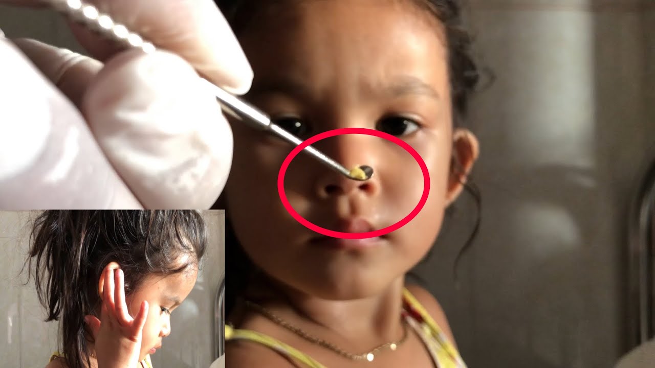 Mineral Oil For Ear Wax