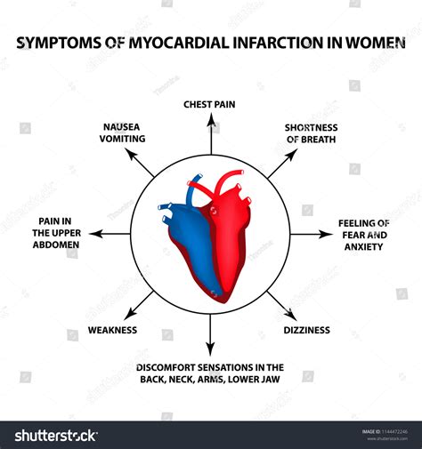 Myocardial Infarction Women Symptoms