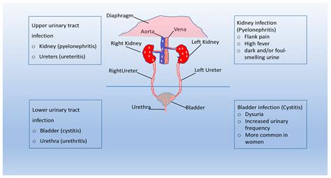 Pathogenesis Of Urinary Tract Infections Encyclopedia Mdpi Pathogenesis Of Urinary Tract Infections Encyclopedia Mdpi