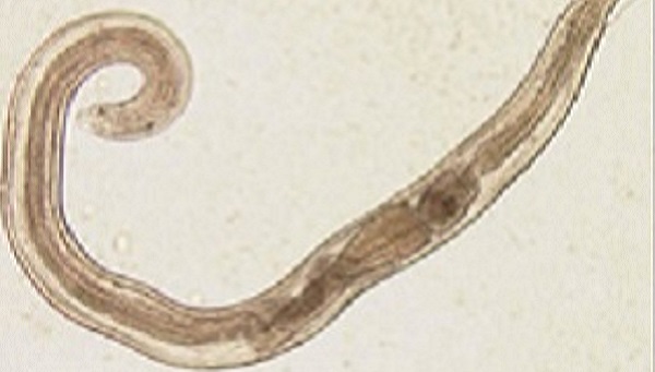 Pinworm Tape Test: Accurate Diagnosis Guaranteed