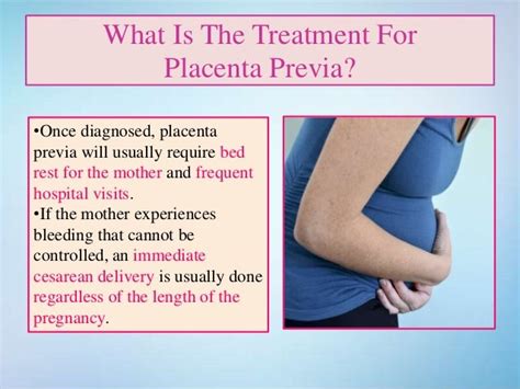 Placenta Previa Treatment Options