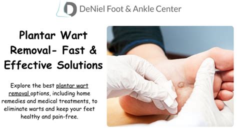 Plantar Warts: Effective Removal Solutions