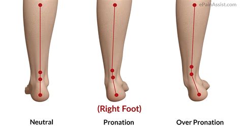 Pronation Of The Foot