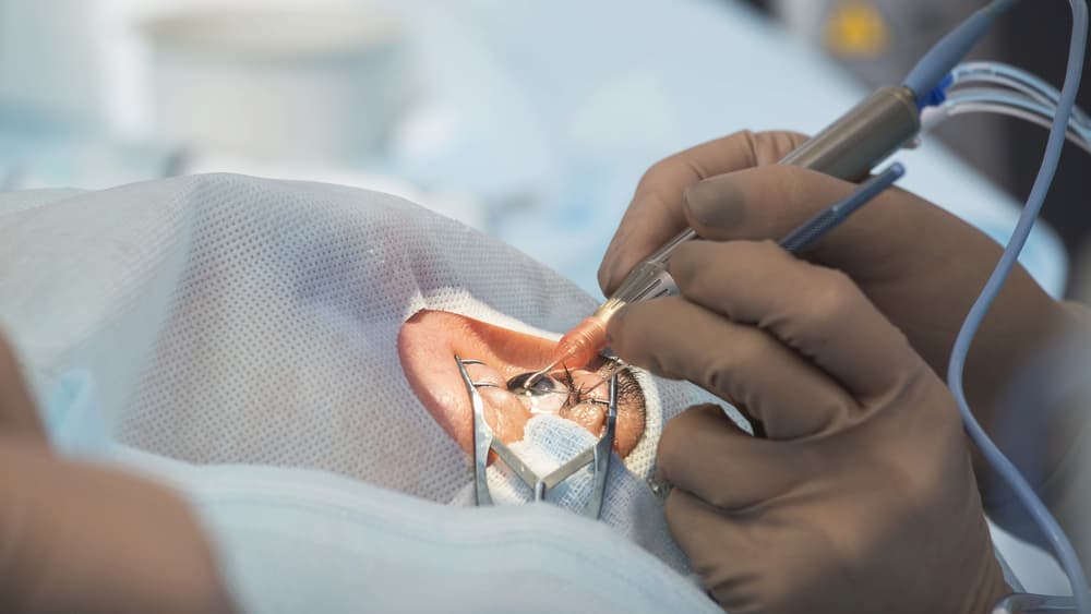 Recovery Time For Cataract Surgery