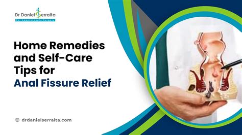Rectal Prolapse Selfcare