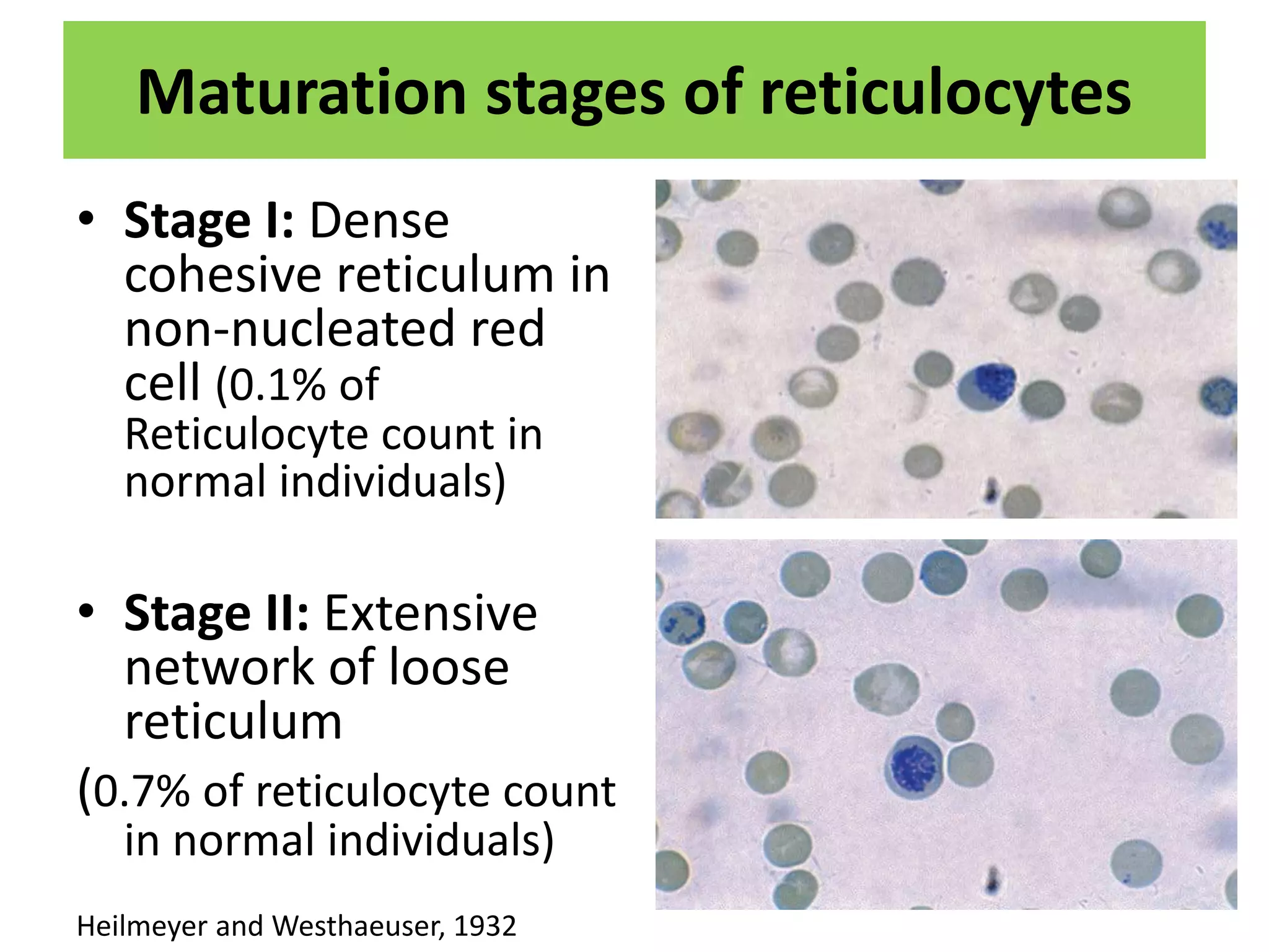 Reticulocyte Count Reticulocyte Count