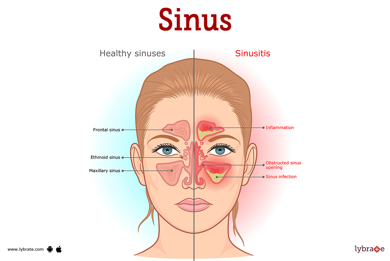 Sinus Rinse Newborn