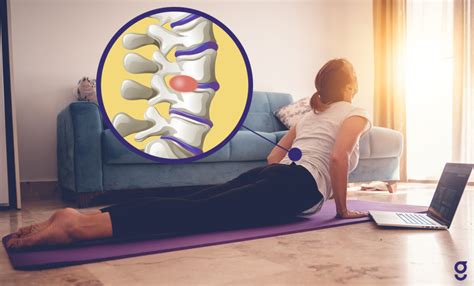 Slipped Disc Exercises: Relieve Back Pain