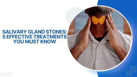 Spit Gland Stone: Effective Treatment Options Found