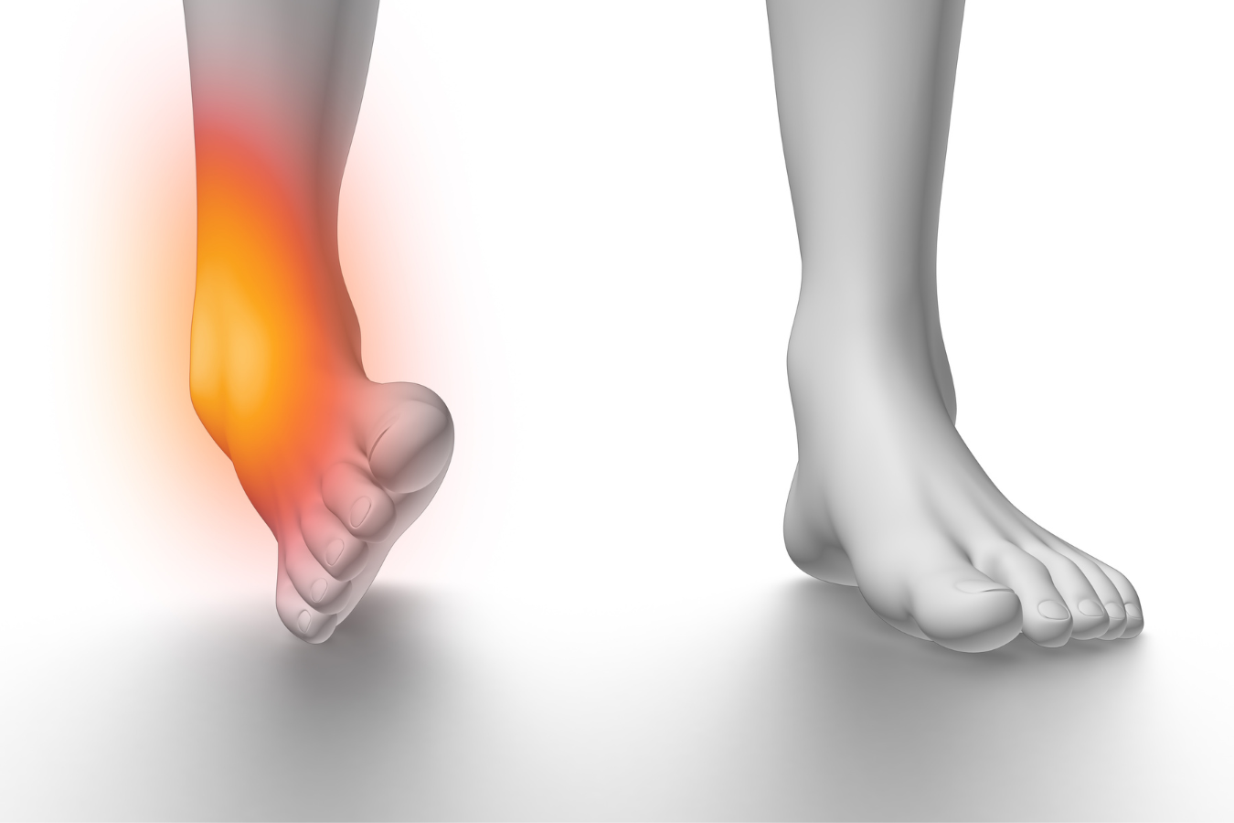 Sprained The Ankle