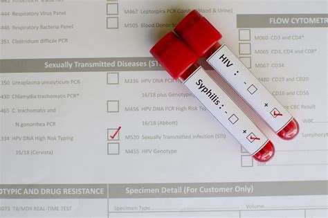 Std Test Results: Know Your Status Today