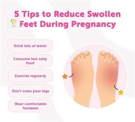 Swollen Feet Pregnancy: Reduce Swelling Naturally