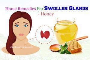 Swollen Gland: Discover Effective Home Remedies