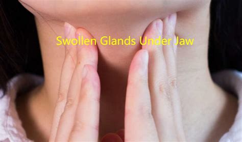 Swollen Glands Below Jaw