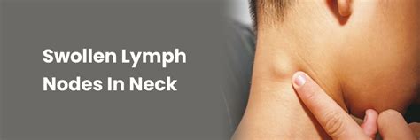 Swollen Lymph Glands Guide: Diagnosis & Relief