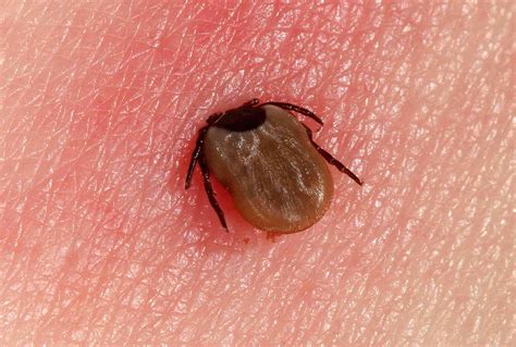 Swollen Tick Bite