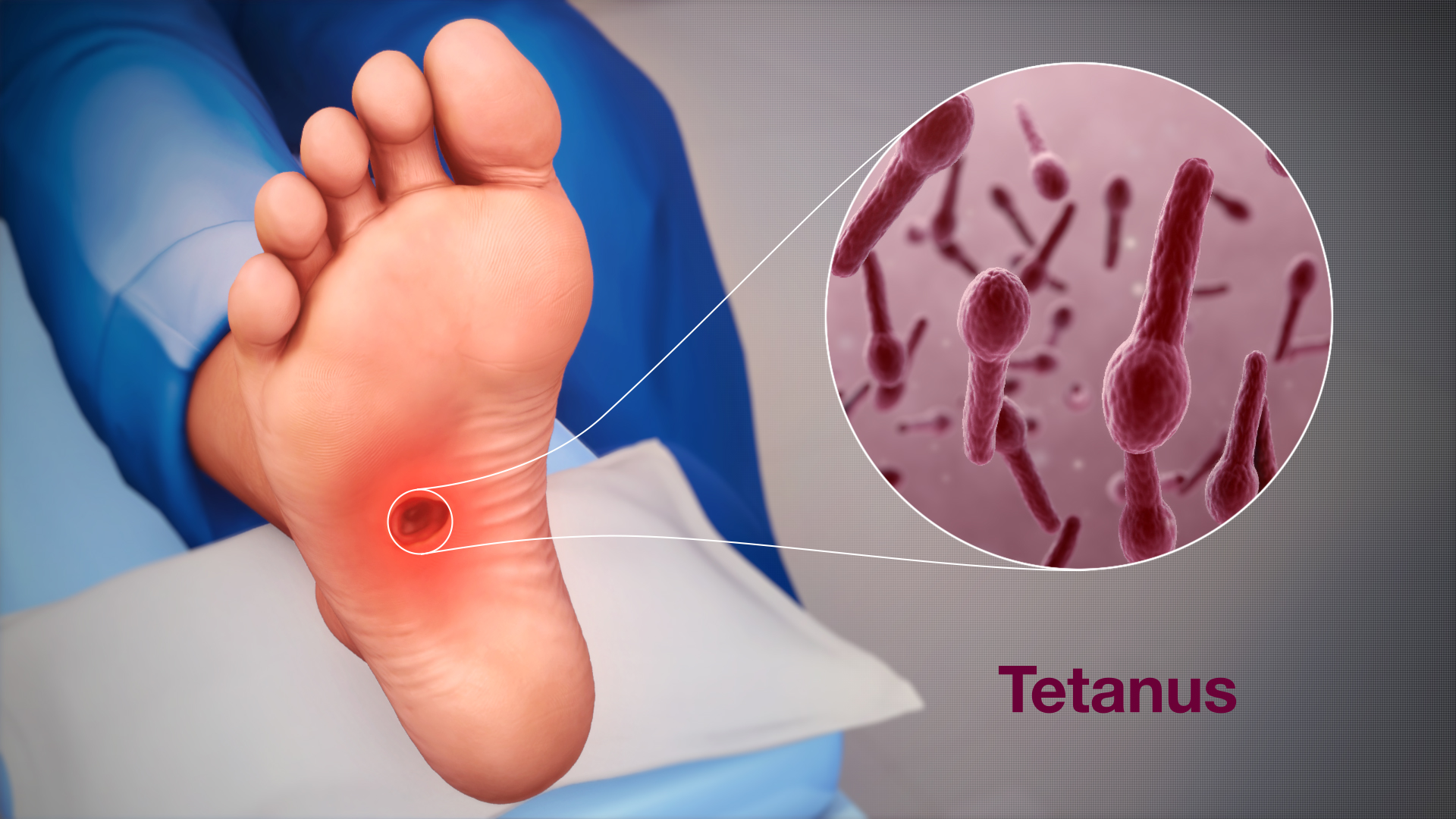 Tetanus Shot Cost Revealed: Save Money