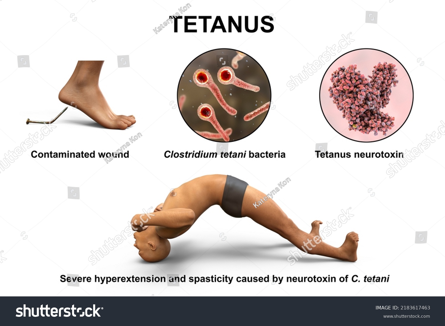 Tetanus Shot Cost