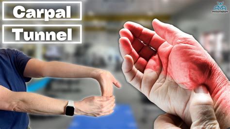 The Best Treatments For Carpal Tunnel Syndrome Youtube The Best Treatments For Carpal Tunnel Syndrome Youtube