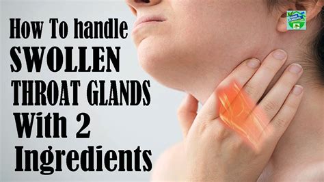 Throat Gland Swelling