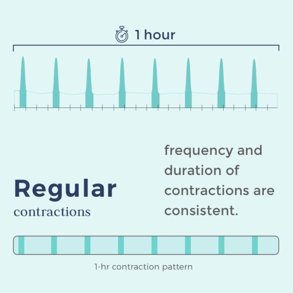 Timing Contractions What You Need To Know Bloomlife Timing Contractions What You Need To Know Bloomlife