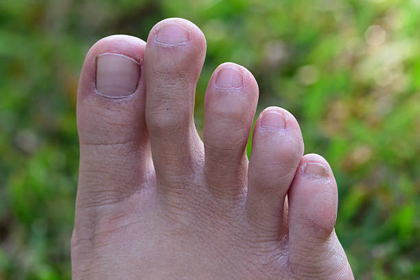 Toe Nail Doctor: Expert Care Guide
