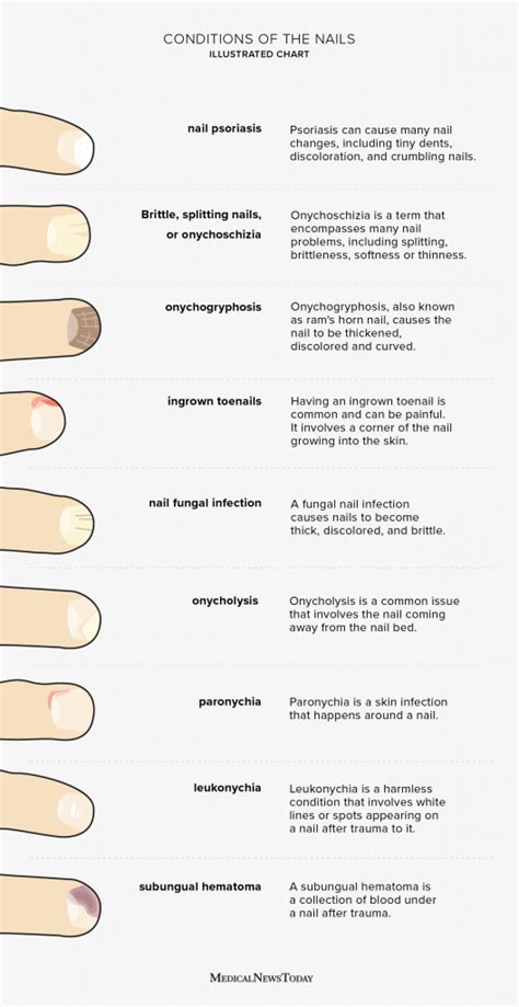 Toe Nail Health: Diagnosis & Treatment Solutions