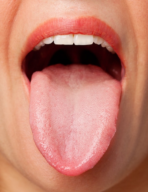 Tongue Bite Remedies: Heal Quickly