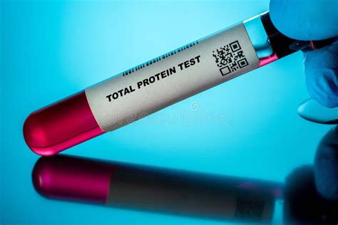 Total Protein Test Blood Tests For Older Adults Recommended Blood Test