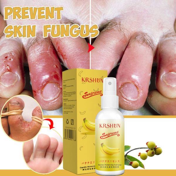 Treating Blisters On Feet