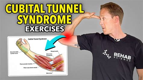 Ulnar Nerve Entrapment Exercises