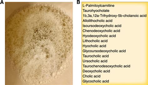 Urine Foam Guide: Diagnosis And Treatment
