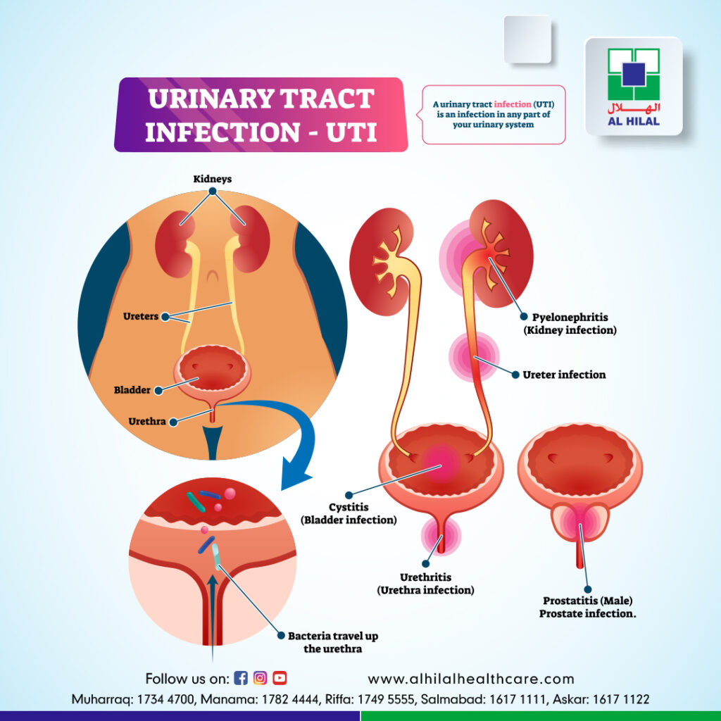 Uti Symptoms: Get Accurate Diagnosis