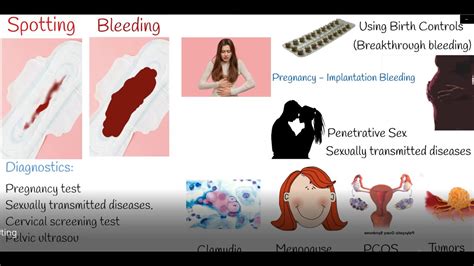Vaginal Bleeding Not Menstrual