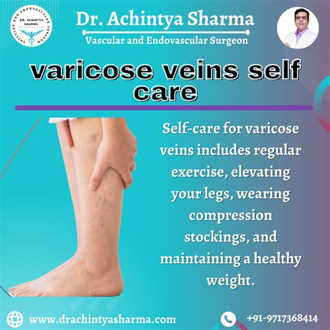 Varicose Veins Selfcare