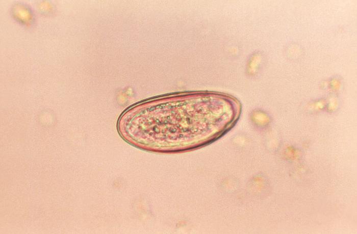 Visible Pinworm Eggs