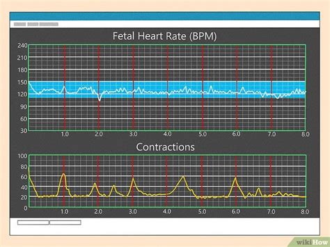 What Are Contraction Monitor Patterns? Decoded For You